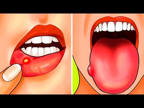 Видео о препарате Фертина Инозит   Фолиевая кислота пак. саше 3г 30шт